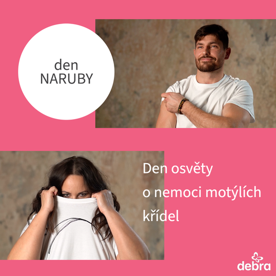 den_NARUBY-9